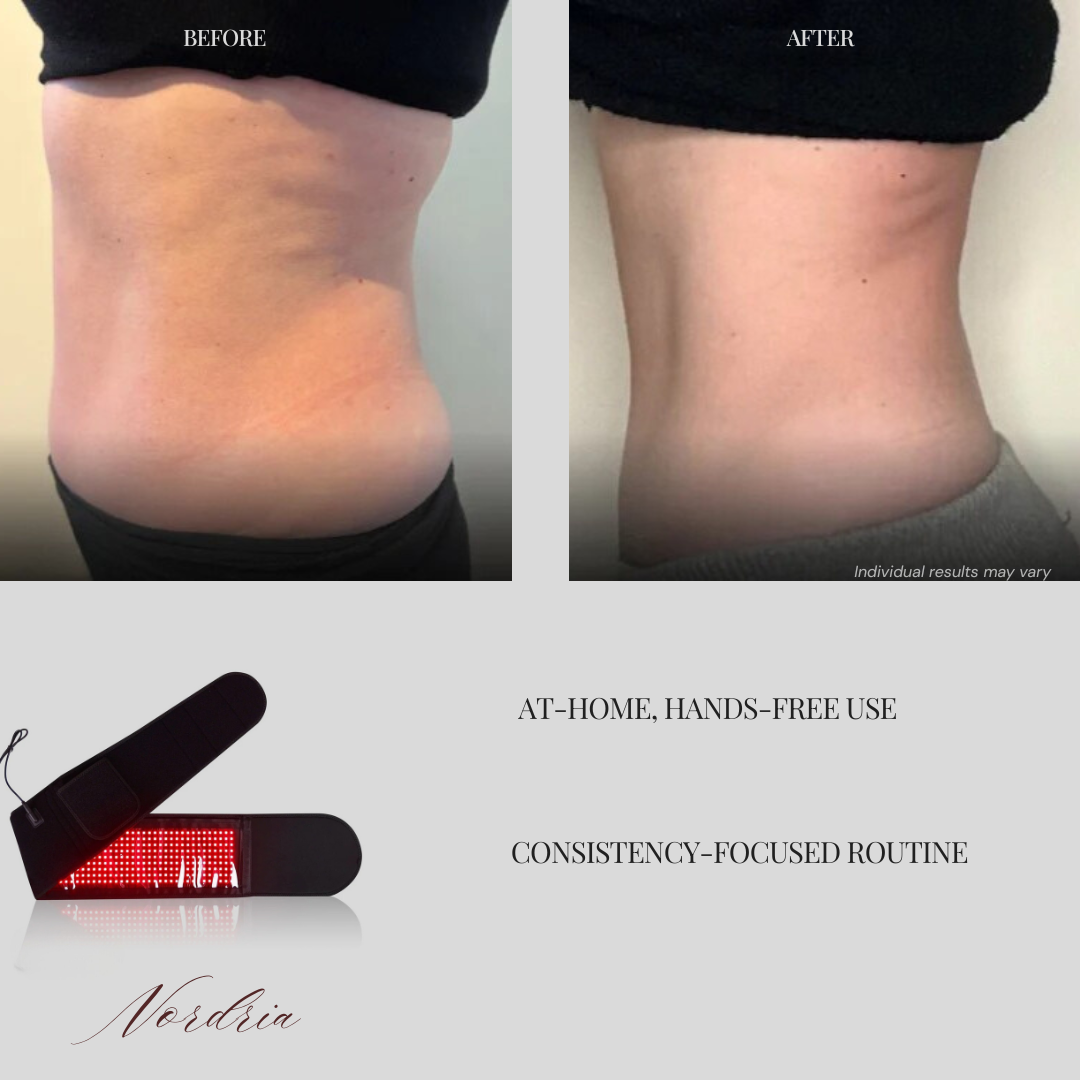 Nordria InfraEase™ Therapy Belt